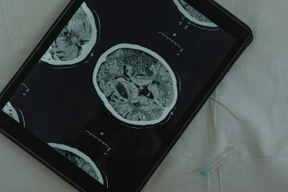 brain scan